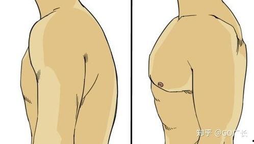 成人驼背怎么矫正视频,跟随视频轻松恢复挺拔身姿